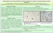 32 - DETERMINACIÓN DEL FACTOR DE CRECIMIENTO