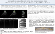 60 - RESTITUCIÓN DE LA BASE ÓSEA