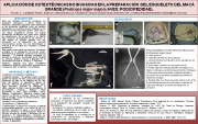 63 - Aplicación de osteotécnicas